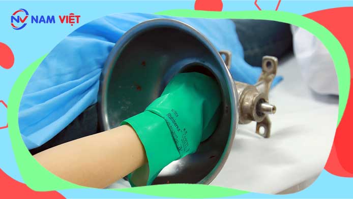 Người phụ nữ bị cuốn bàn tay vào máy xay thịt