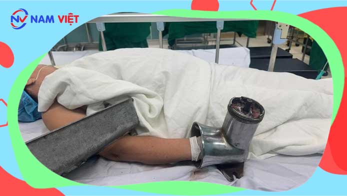 Người phụ nữ bị cuốn bàn tay vào máy xay thịt