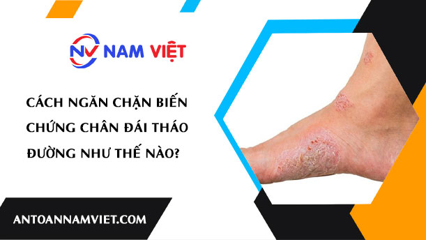 CÁCH NGĂN CHẶN BIẾN CHỨNG CHÂN ĐÁI THÁO ĐƯỜNG NHƯ THẾ NÀO?